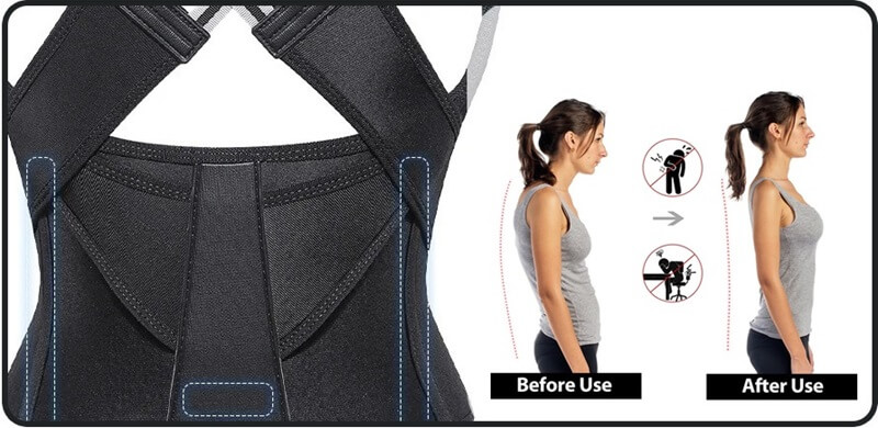 Back Support Brace Posture Corrector - Improve Bad & Poor Posture For Men & Women