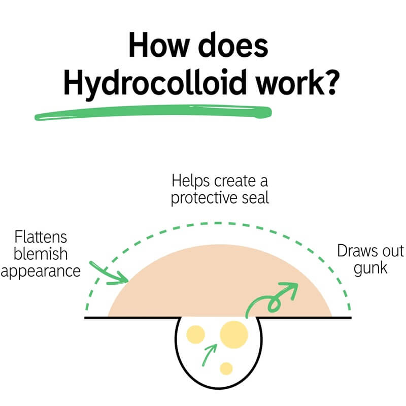 Hydrocolloid Pimple Patches - Stickers For Zit Acne Blemish