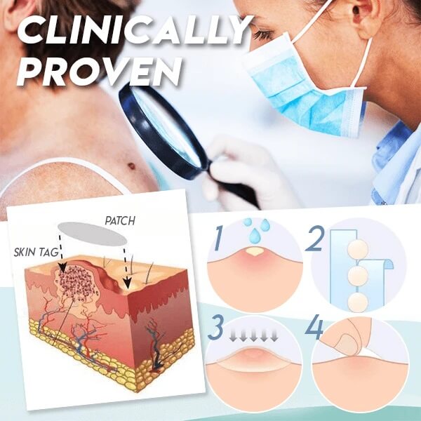Skin Tag Wart Mole Removal Patch - Eliminate Acrochordon On Skin Eyelid Neck Armpit At Home