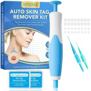 Skin Tag & Wart Removal - Eliminate Acrochordon On Skin Eyelid Neck Armpit At Home