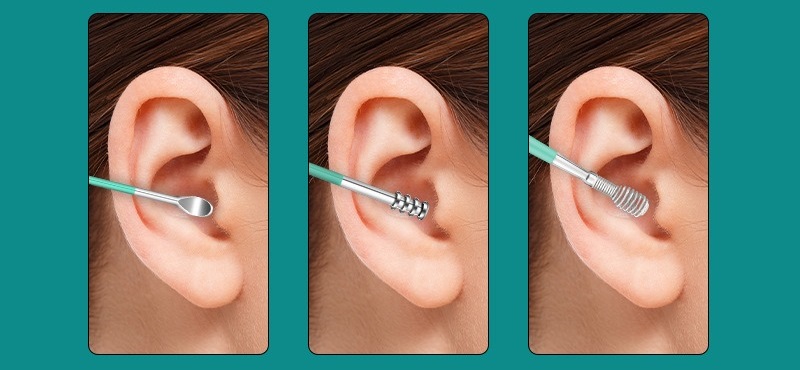 Ear Wax & Cerumen Removal Kit - Ear Dirt Remover & Impacted Earwax Cleaner