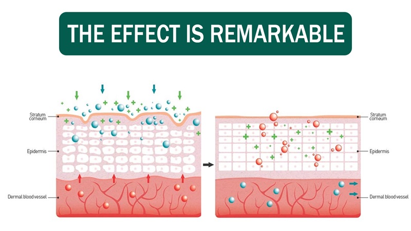 Scar & Keloid Removal Healing Treatment Cream At Home