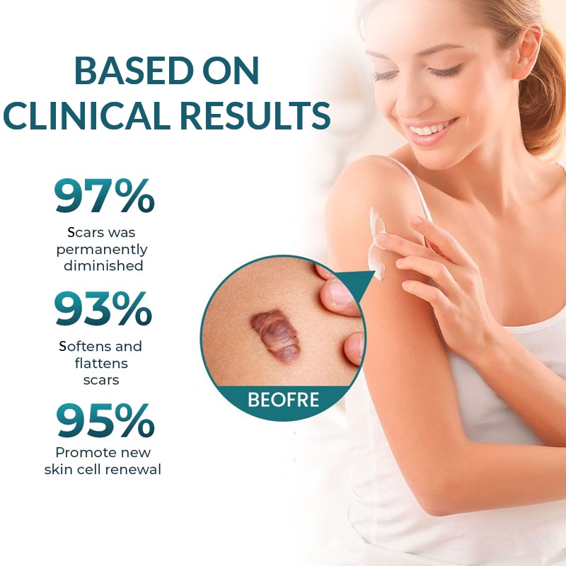 Scar & Keloid Removal Healing Treatment Cream At Home